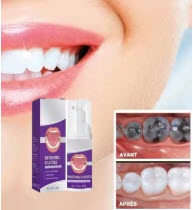 Teeth Whitening & Oral Care Products for a Brighter Smile