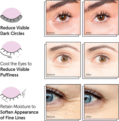 Under Eye Mask - Dark Circles, Puffiness, Wrinkles - Vegan Eye Patches(48 Pairs)
